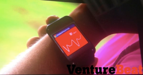 Apparition Du Smartphone Et De Son Appareil Photo Intégré Galaxy Gear : première photo de la montre de Samsung ? - KultureGeek