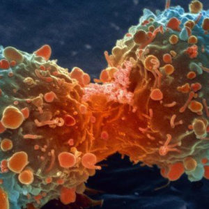 Image article Cancer : une IA prédit le comportement de cellules face à divers traitements