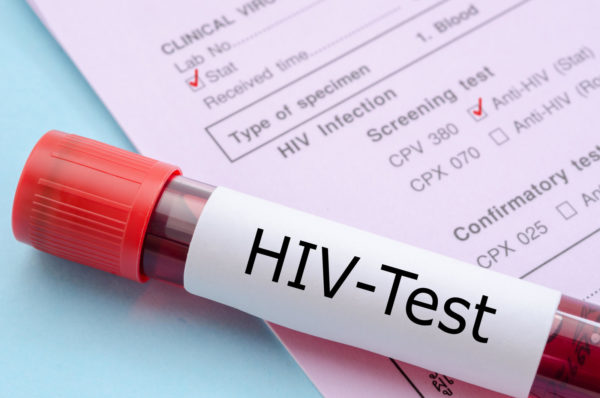 HIV TEST