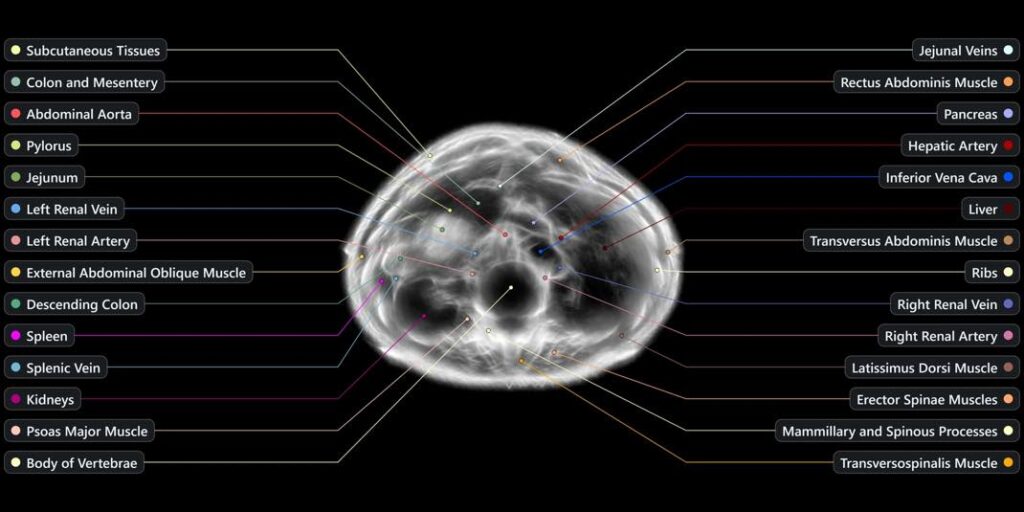 Midjourney Scanner 1