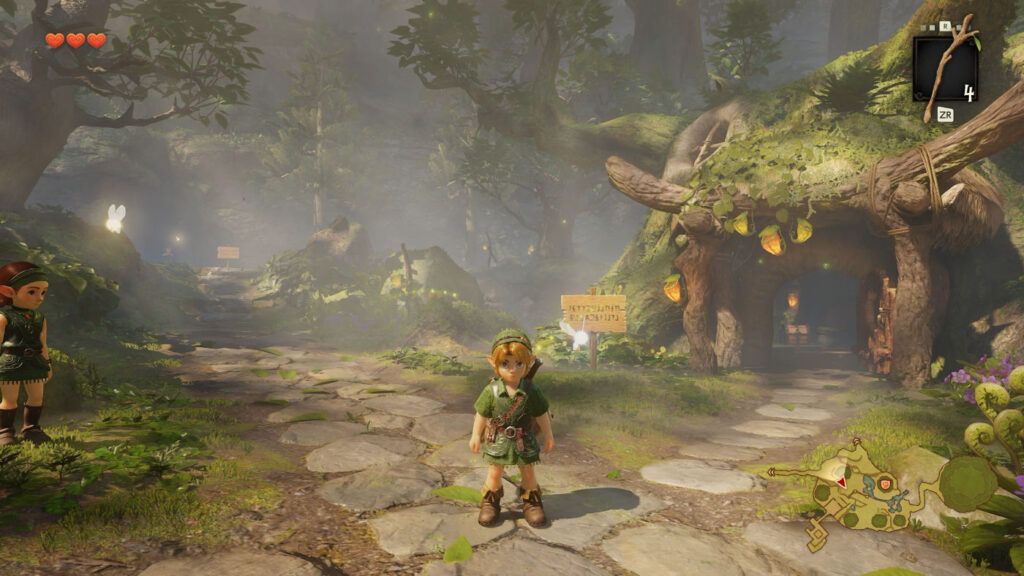 The Legend f Zelda Ocarina of Time Remake Gameplay