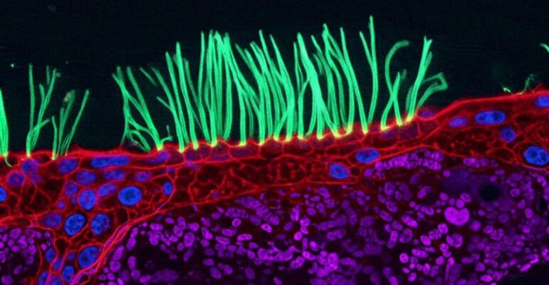 image scientifique modifiée par IA - Nikon